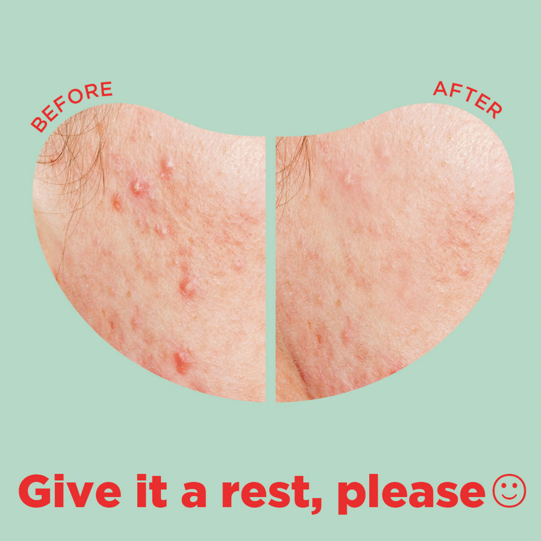 Cica Calming – Big Spot Patch_05