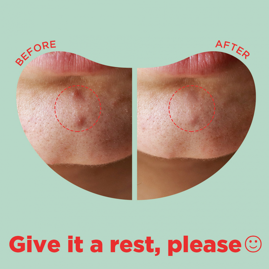 Cica Calming – Big Spot Patch_06