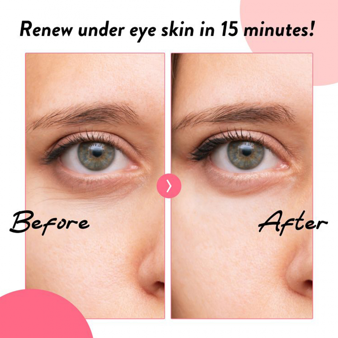 My Collagen Hydrogel Eye Patch_04