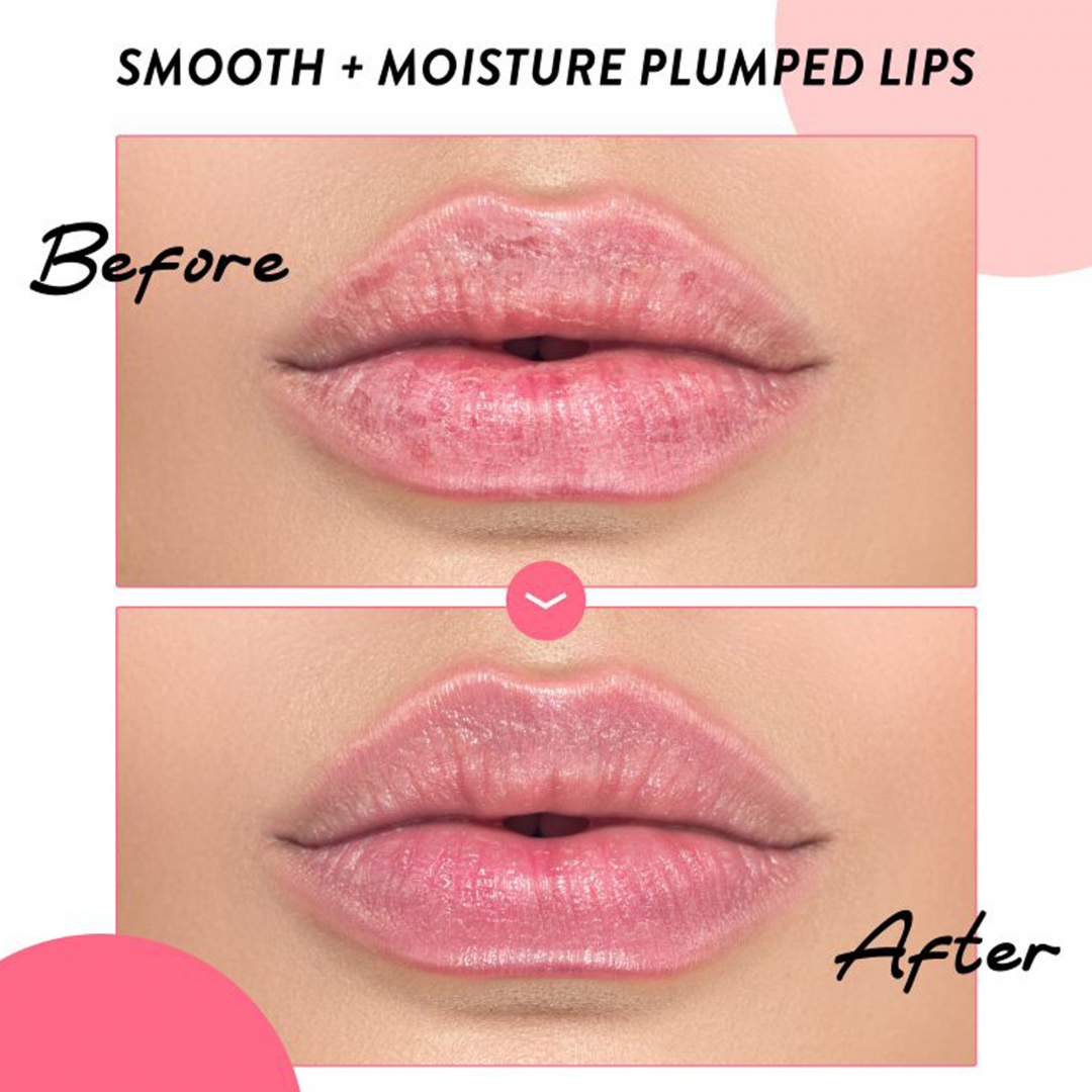 My Collagen Hydrogel Lip Patch_04