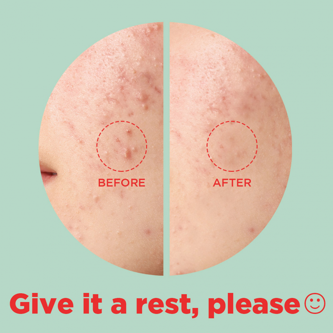 Tea Tree Clear – Dot Patch_07