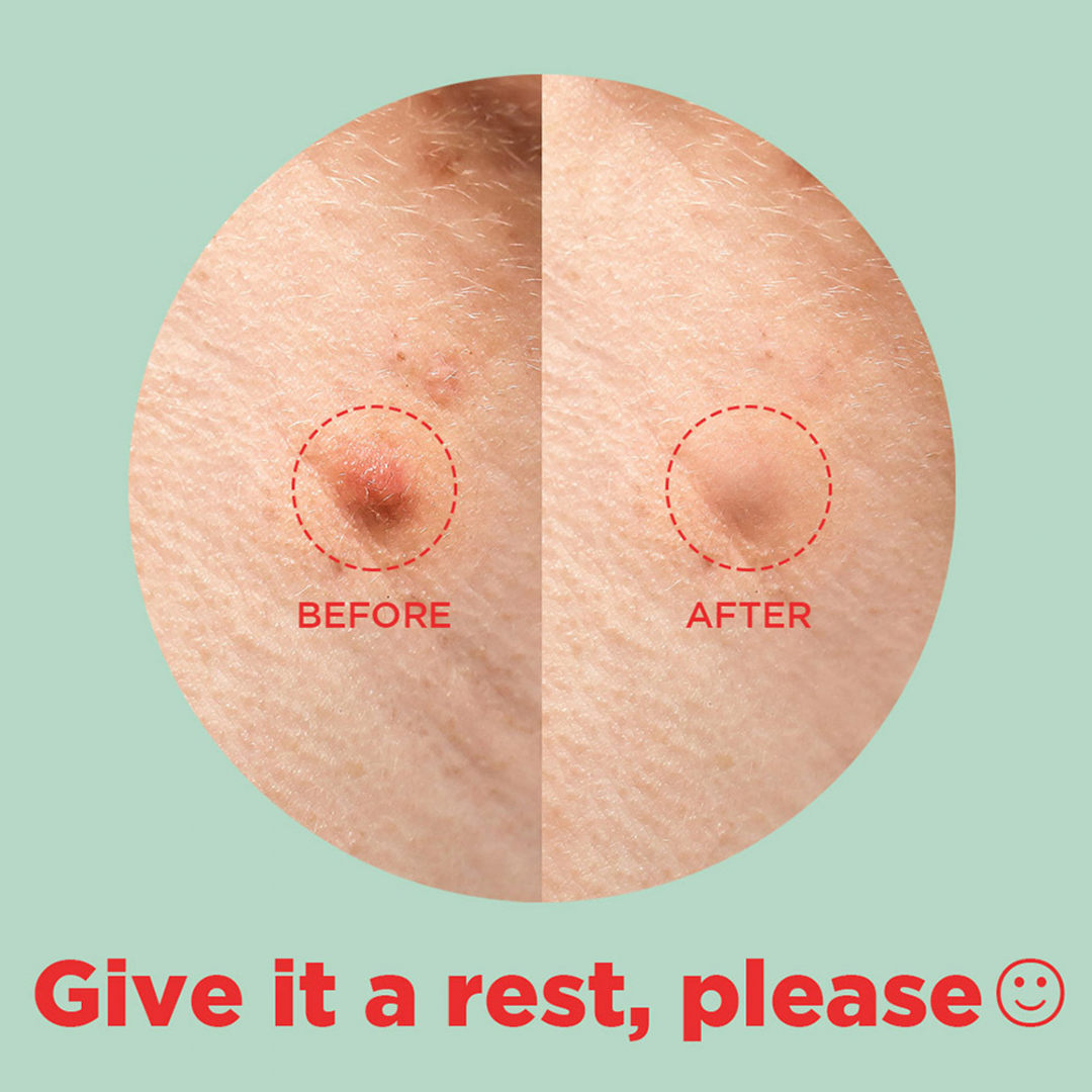 Tea Tree Clear – Dot Patch_08