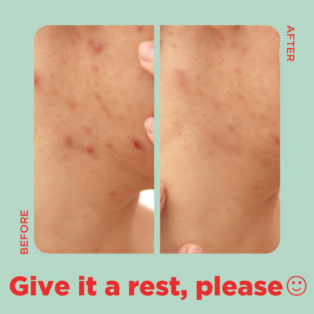 Tea Tree Clear – Square Patch_05