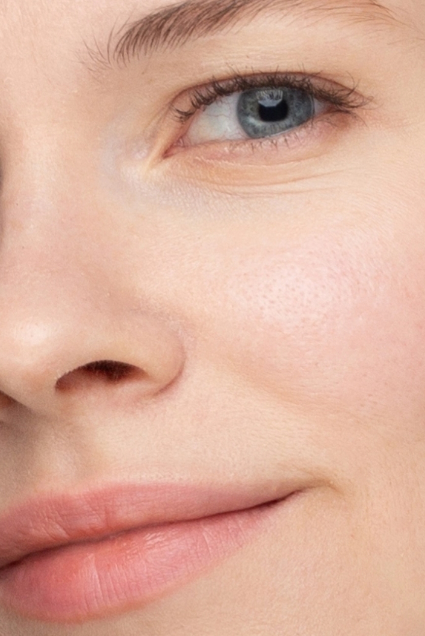 dry and dehydrated skin